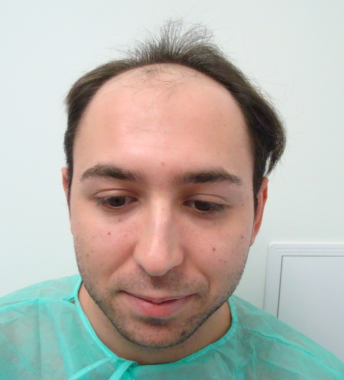 Before