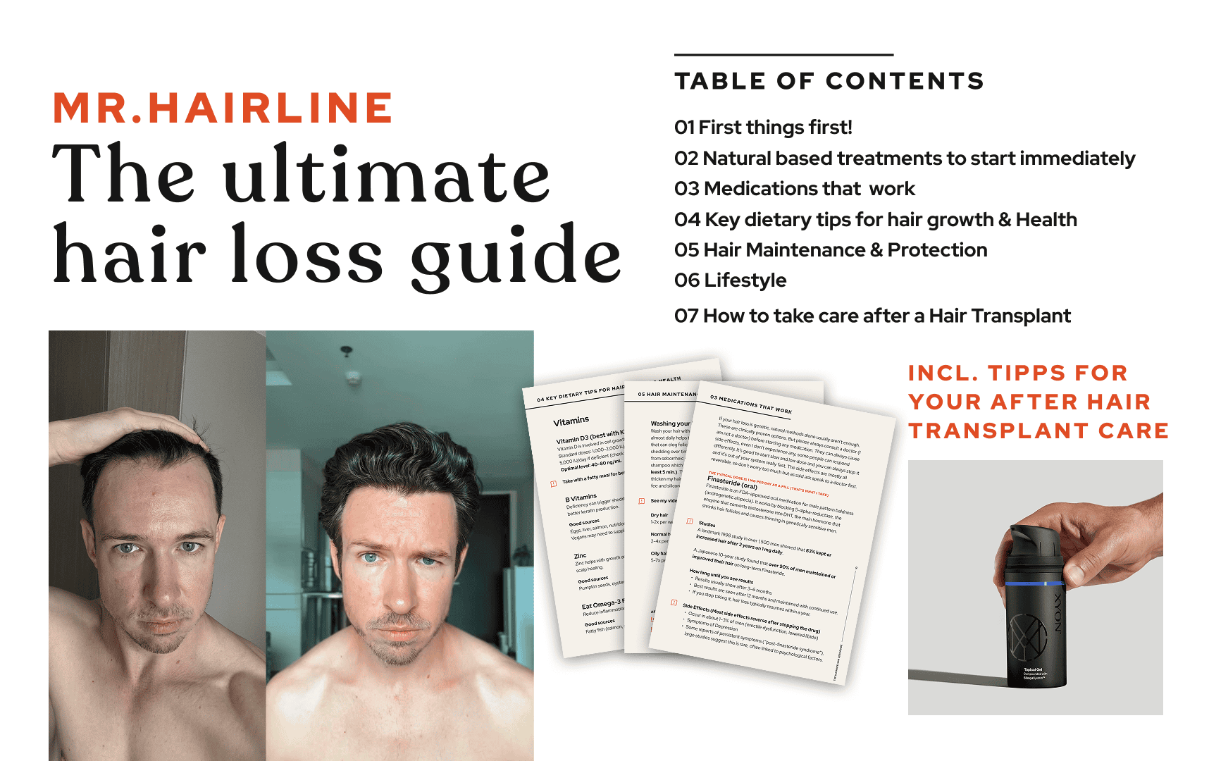My (FREE) Ultimate Hair Loss Guide V1.0